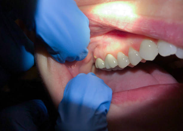 Best Emergency Denture Repair in Newton, KS
