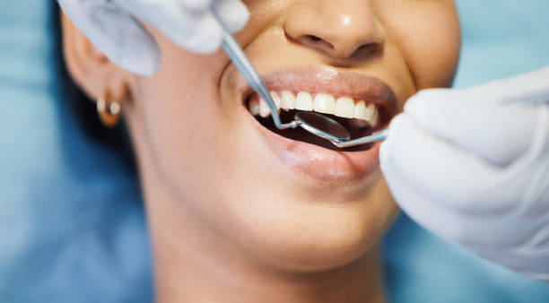 Best Emergency Root Canal Treatment in Newton, KS