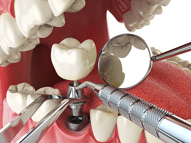 Best Emergency TMJ Treatment in Newton, KS